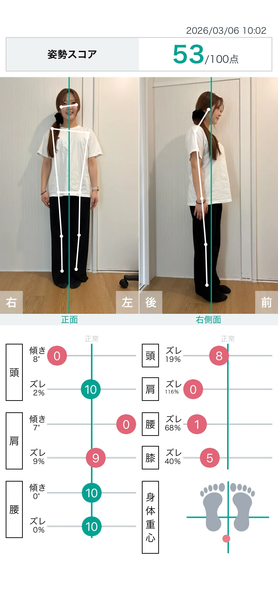 施術前 姿勢スコア
