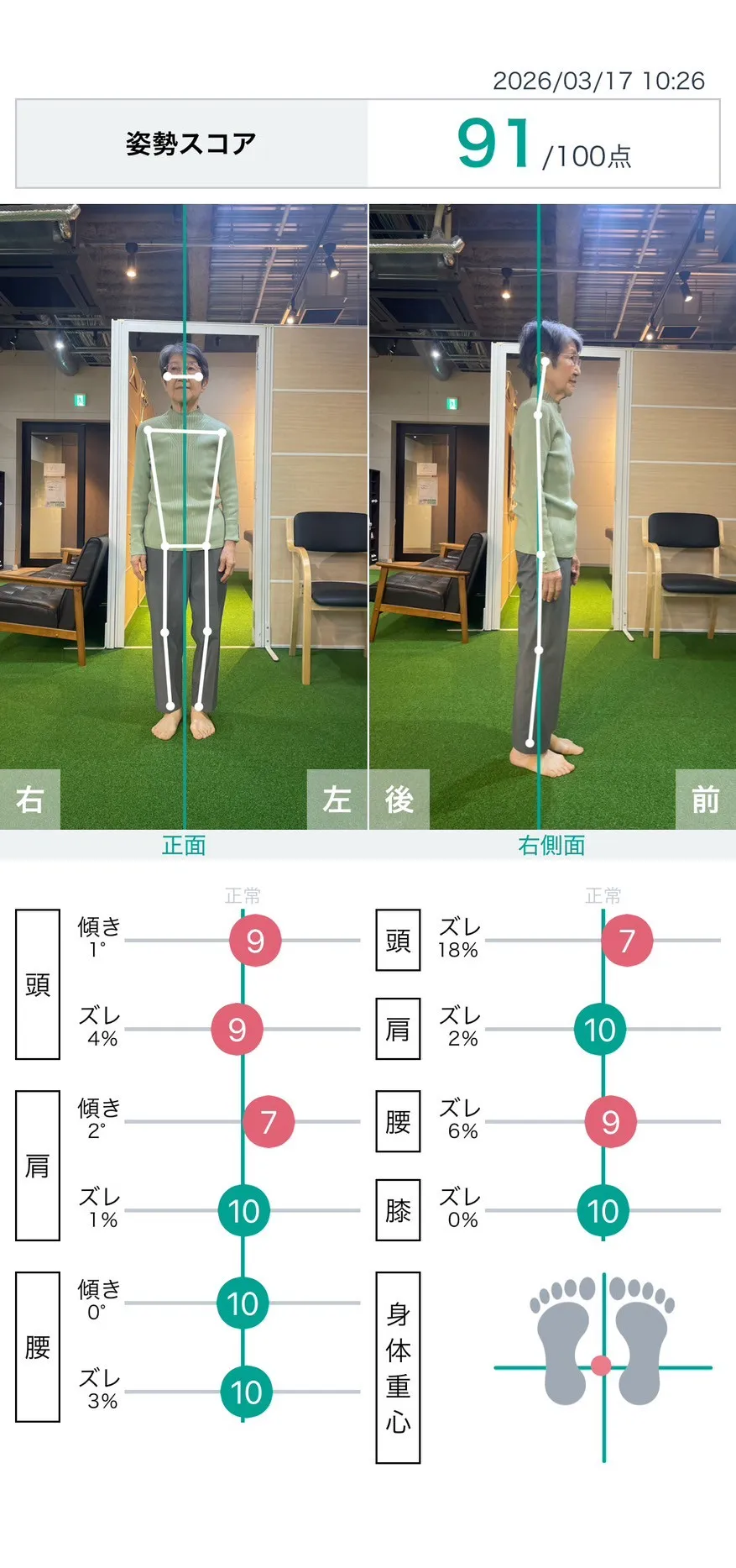 施術後 姿勢スコア