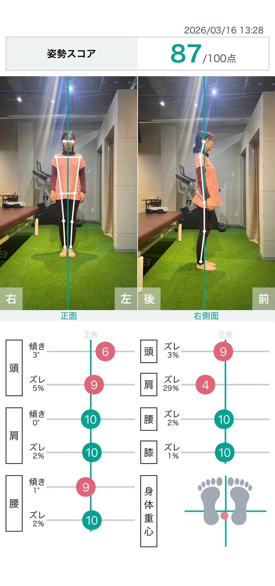 施術前 姿勢スコア
