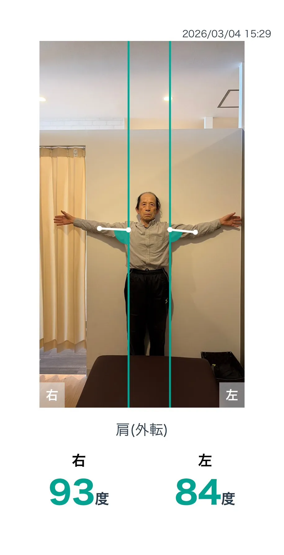 施術前 肩の可動域