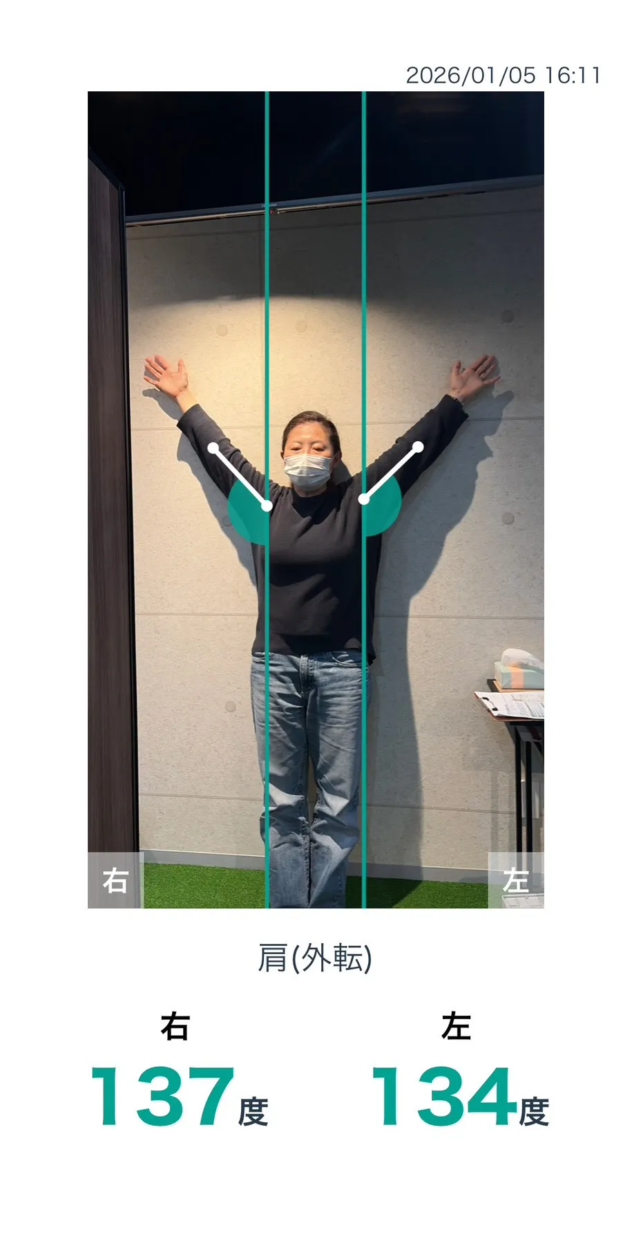 施術後 肩の可動域