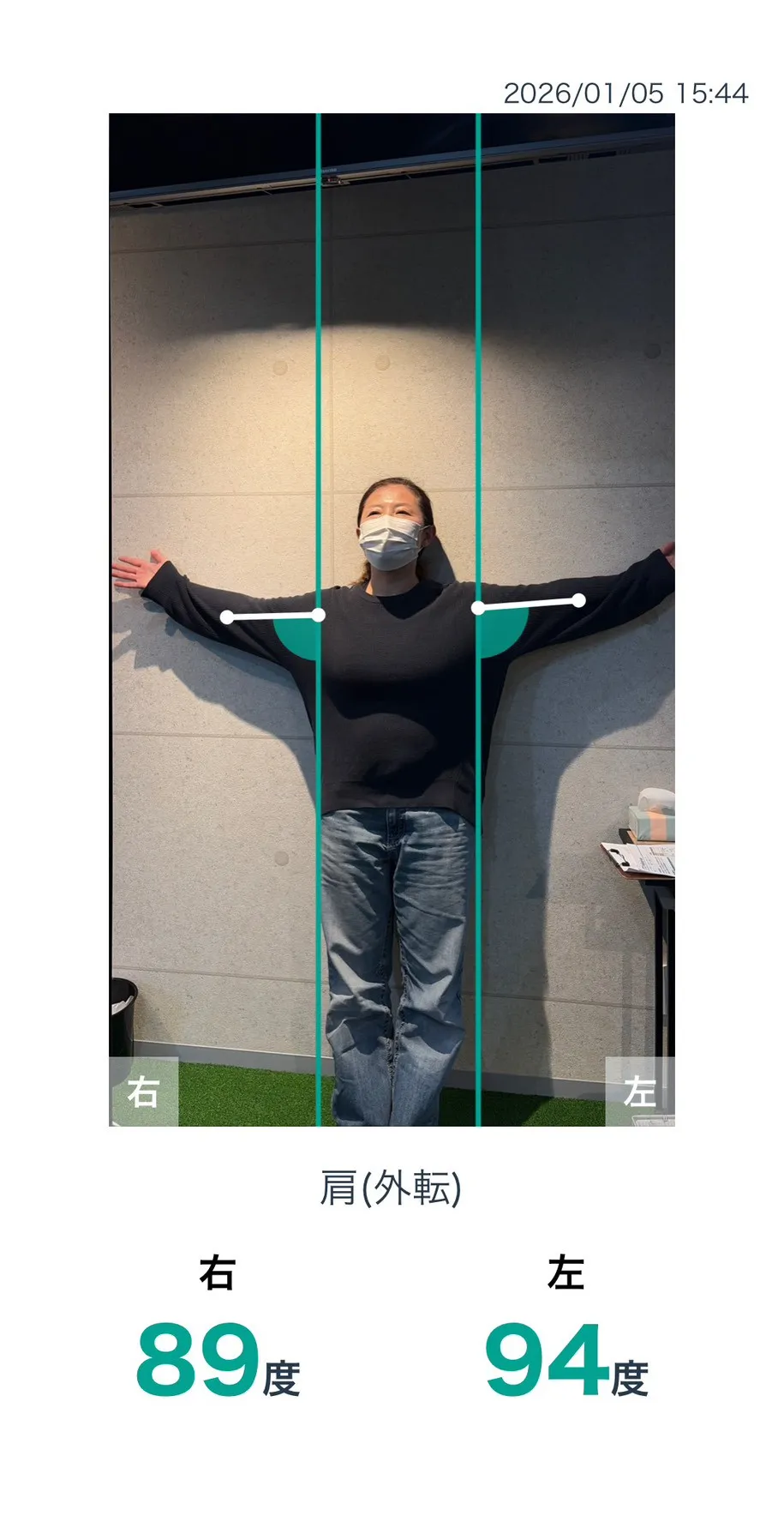 施術前 肩の可動域