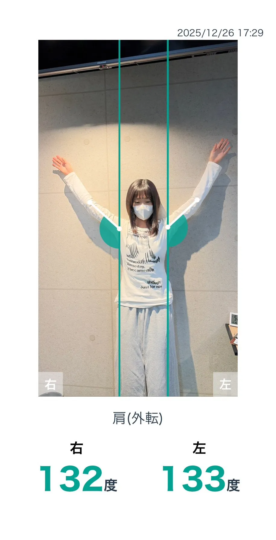 施術後 肩の可動域