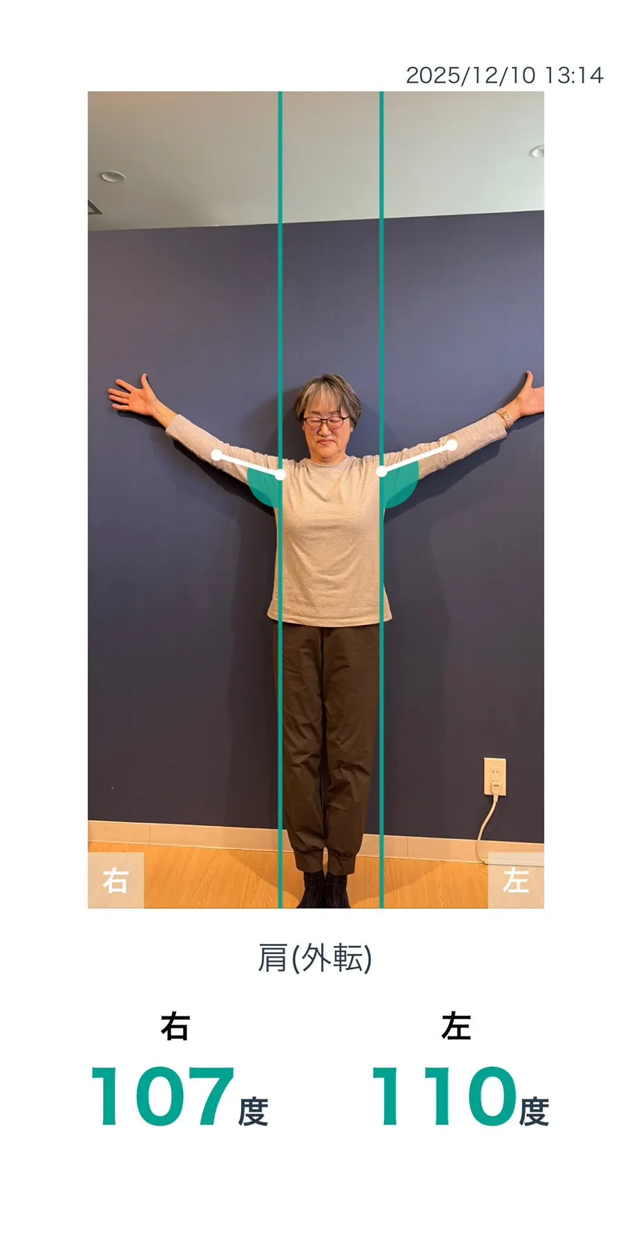 施術前 肩の可動域