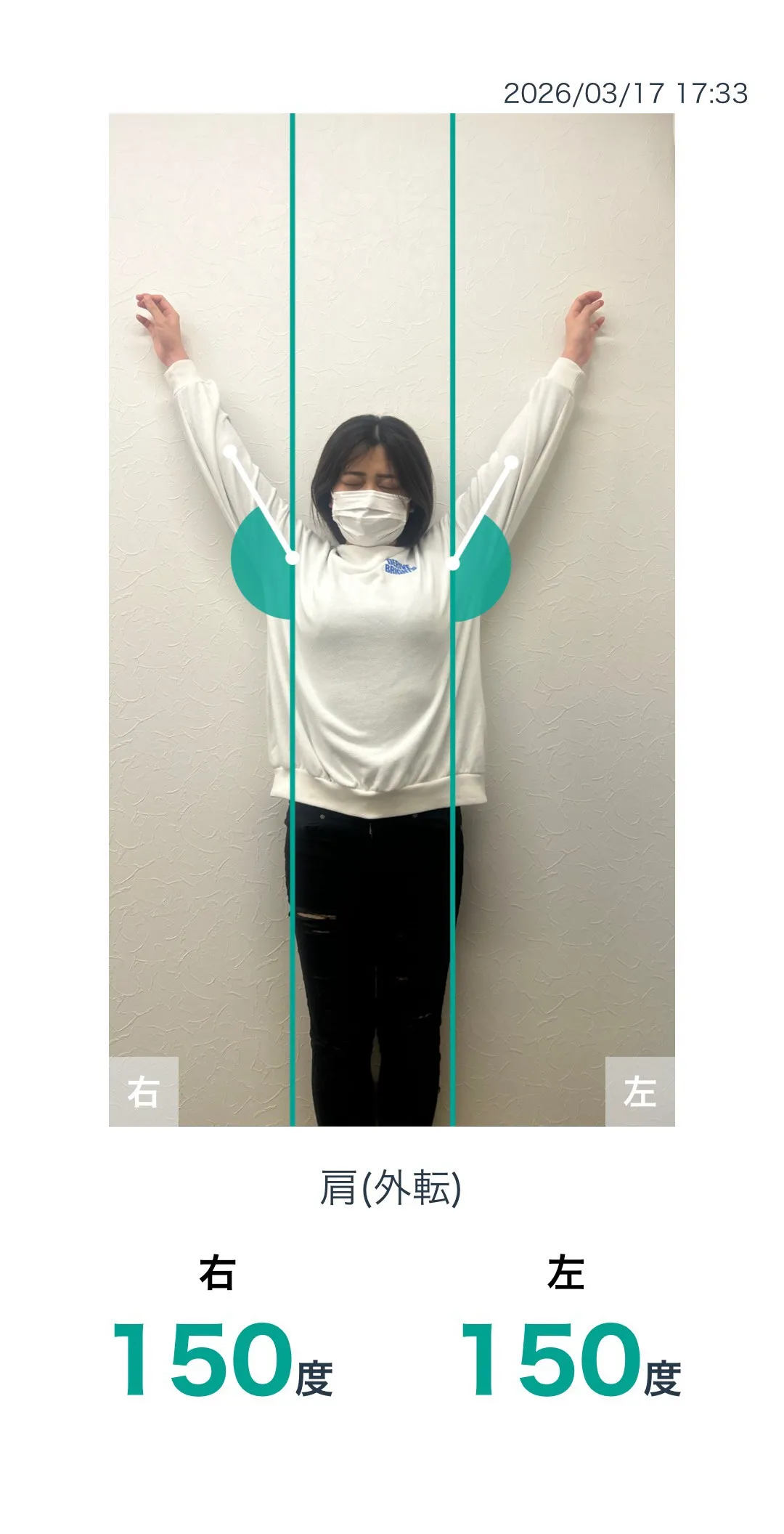 施術後 肩の可動域