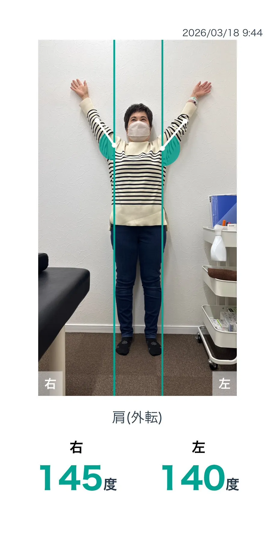 施術後 肩の可動域