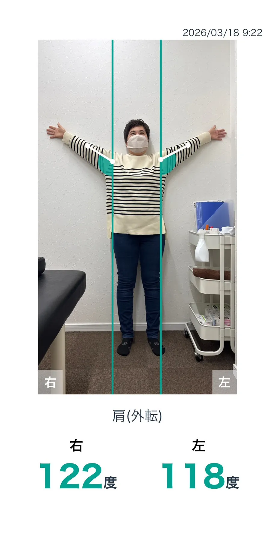施術前 肩の可動域